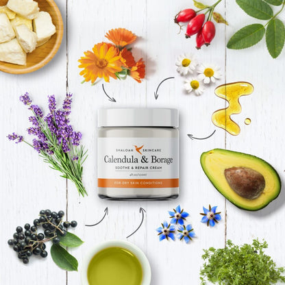 Calendula Cream for Eczema, Natural Moisturiser for Dry Skin